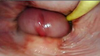 AMAZING INTERNAL POV. CAMERA INSIDE HER PUSSY WHILE I FILL HER WITH CUM